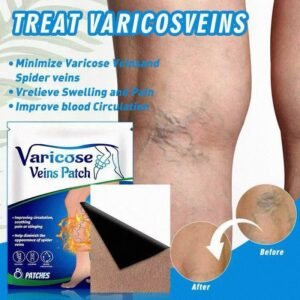 Parche Varices